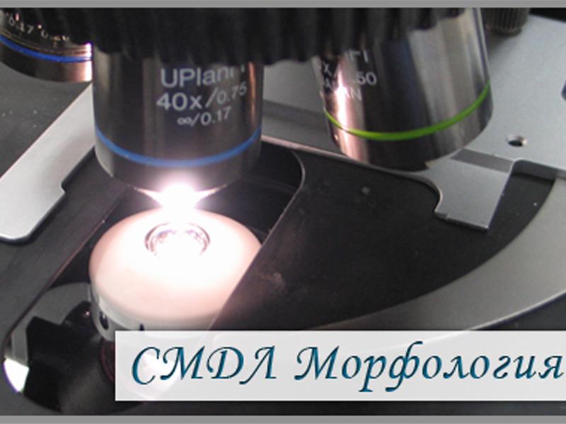 Основно изображение на фирма СМДЛ Морфология - хистологични и цистологични изследвания Плевен